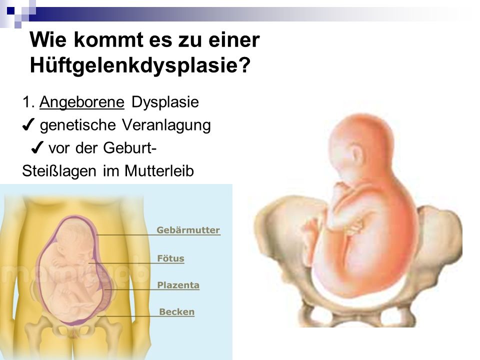 Ob Operation nach der Abtragung der Hämorrhoide machen